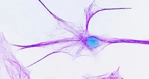 300x160-neurohirurgija